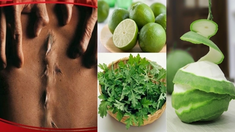 Khám phá bài thuốc chữa gai cột sống cực đơn giản tại nhà 1