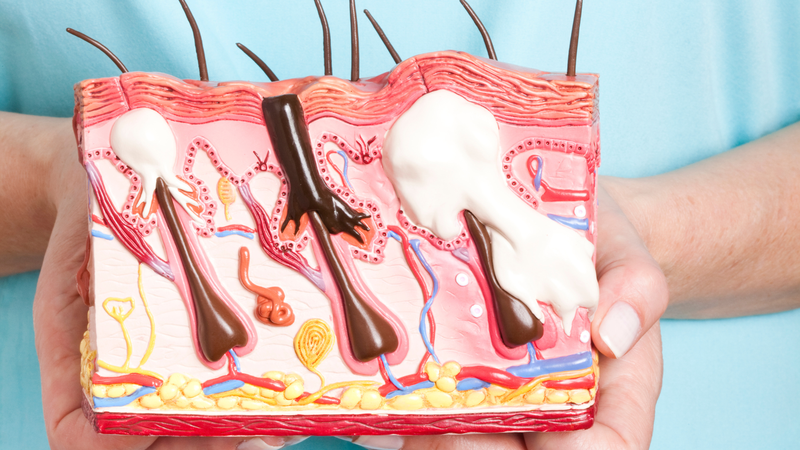 Khám phá: Cơ chế hình thành mụn và một số lưu ý khi điều trị mụn 2