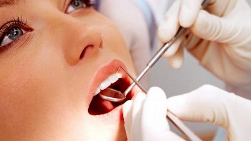 Khám phá quy trình đính đá lên răng 4