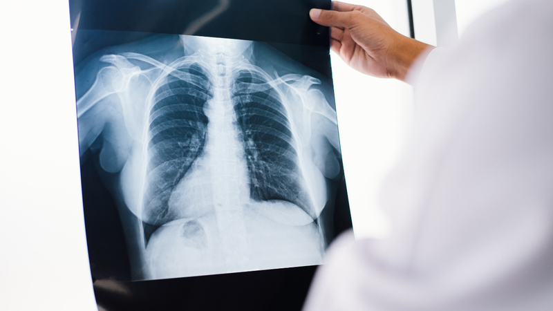 Khám phổi tại Bệnh viện Phổi Đà Nẵng 3