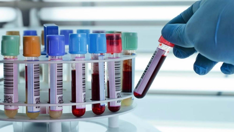 Khám sức khỏe sinh sản 2 vợ chồng bao gồm những gì? 2