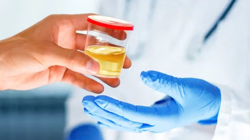 Khám thận gồm những gì? Cần chuẩn bị gì trước khi khám thận? 2