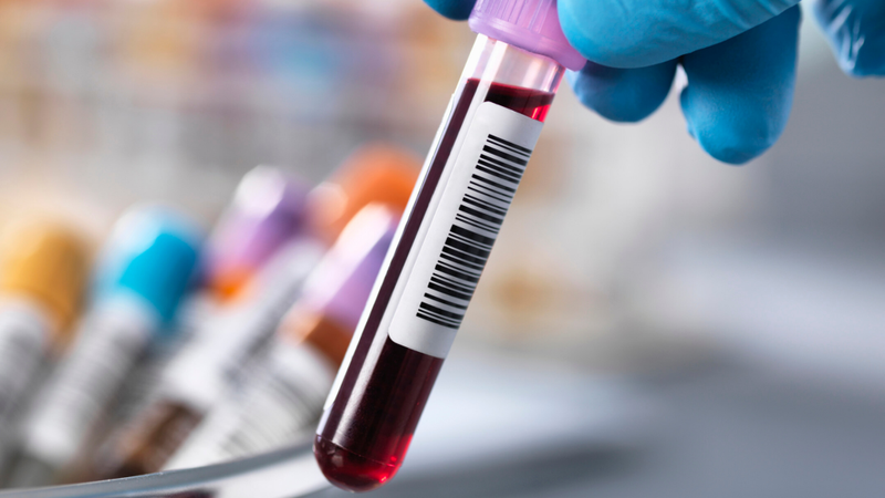 Khám thận gồm những gì? Cần chuẩn bị gì trước khi khám thận? 1