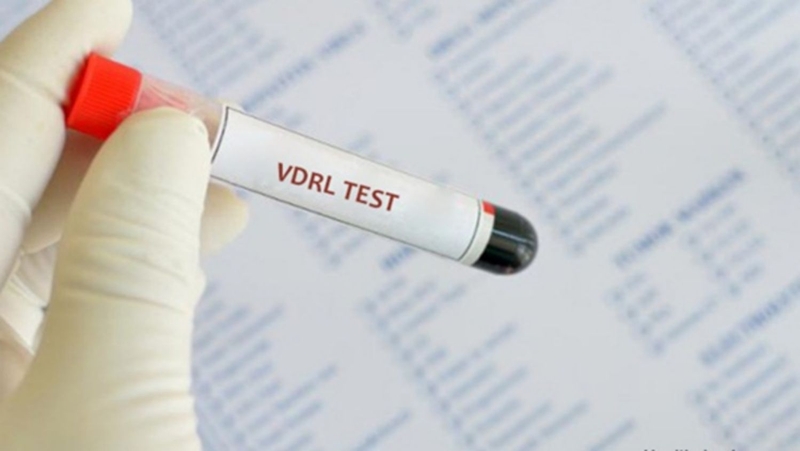 Xét nghiệm kiểm tra sàng lọc VDRL