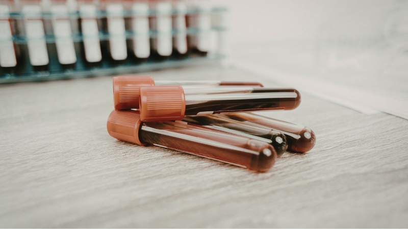 Xét nghiệm máu chẩn đoán sức khỏe tổng quát