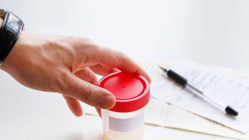 Xét nghiệm tinh dịch đồ là phần rất quan trọng trong khám sức khỏe tiền hôn nhân ở nam