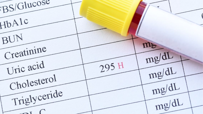 Một vài chỉ số xét nghiệm trong khám tổng quát có thể gợi ý suy thận