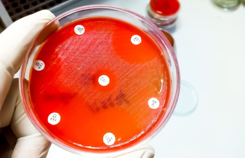 Kháng sinh đồ: Đối tượng chỉ định, cách thực hiện và ý nghĩa của phương pháp 3