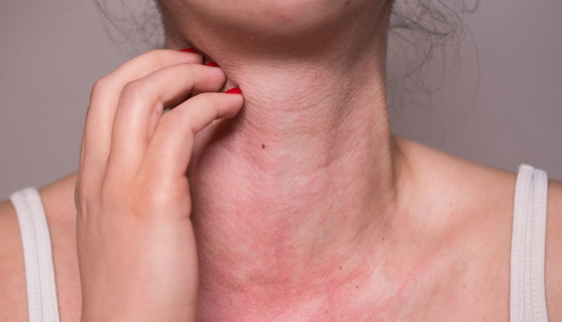 Chi tiết về phác đồ kháng sinh trị viêm phổi do phế cầu 3