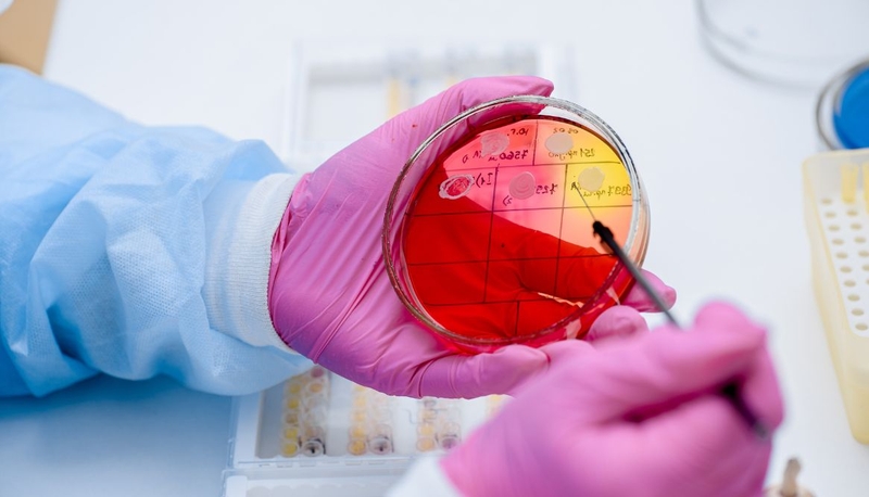 Chi tiết về phác đồ kháng sinh trị viêm phổi do phế cầu 4