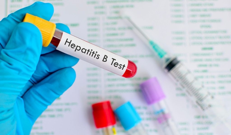 Kháng thể viêm gan B bao nhiêu là đủ và cách tăng kháng thể hiệu quả? 2