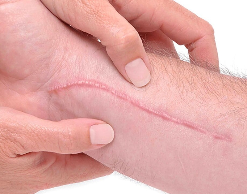 khau-tham-my-la-gi-co-de-lai-seo-khong 4.jpg