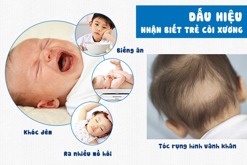 Khi bà bầu thiếu canxi và những tác hại đáng báo động2