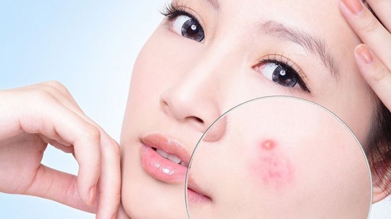 nóng trong người nên uống gì để giải nhiệt