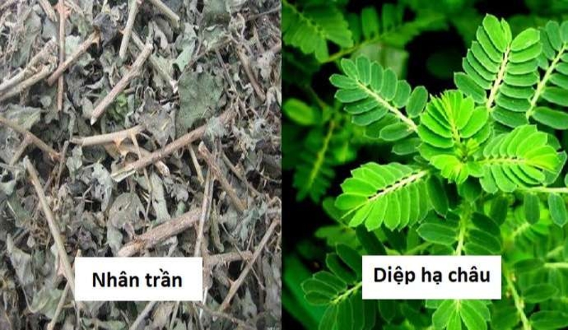 khi bị sỏi túi mật nên uống thuôc gì 4