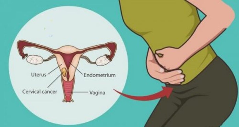 Khi bị trễ kinh đau bụng dưới ra huyết trắng nên làm gì? 3