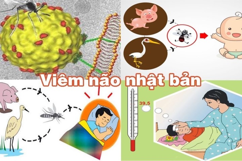 Khi bị viêm não Nhật Bản triệu chứng là gì và cách phòng bệnh ra sao 2
