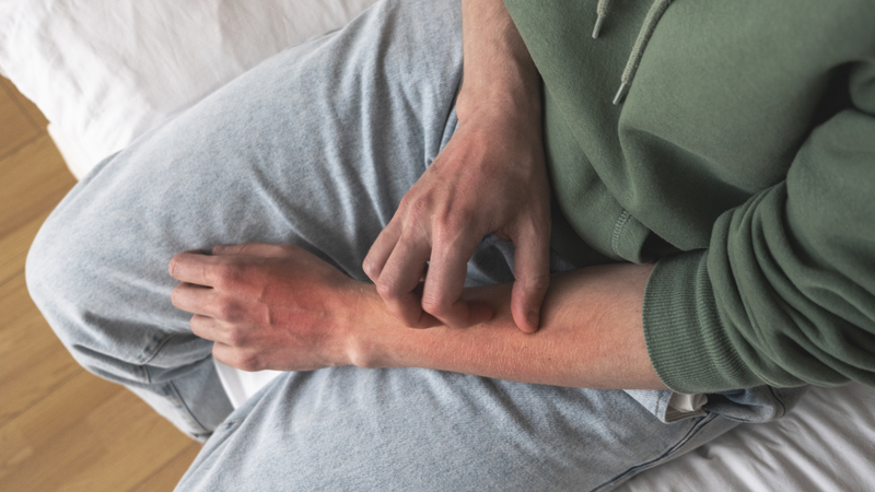 Khi cơ thể chịu nhiệt độ quá lạnh: Mối nguy hại tiềm tàng đến từ bỏng lạnh 4