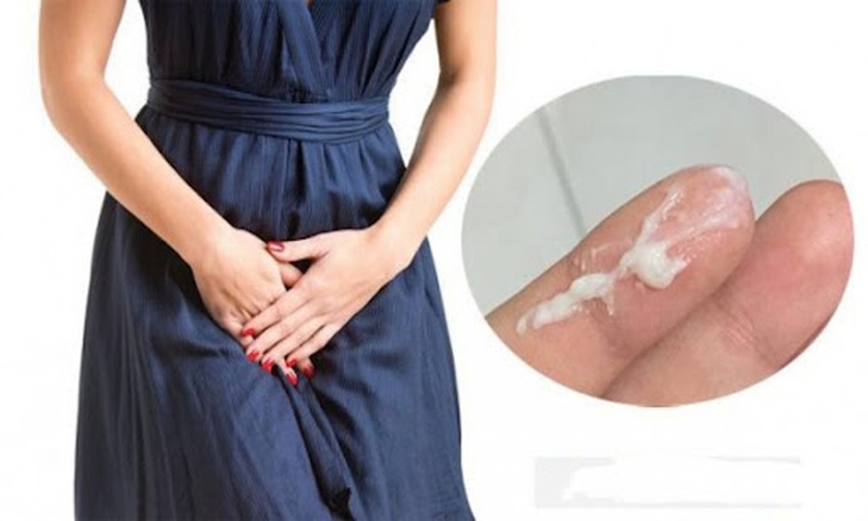 Những chia sẻ chi tiết về khí hư bất thường ở chị em phụ nữ