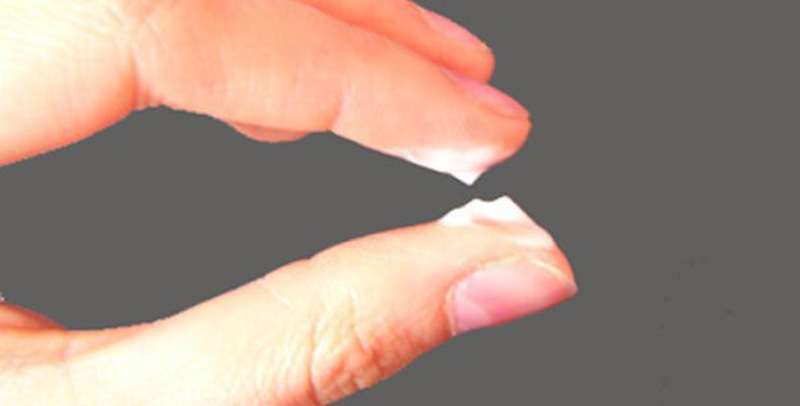 Những biện pháp phòng tránh khí hư bị vón cục