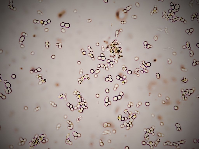 Khí hư có mùi hôi: Nguyên nhân và biện pháp phòng ngừa hiệu quả 2