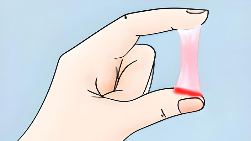 Nguyên nhân gây hiện tượng khí hư có sợi máu có thể bạn chưa biết 1
