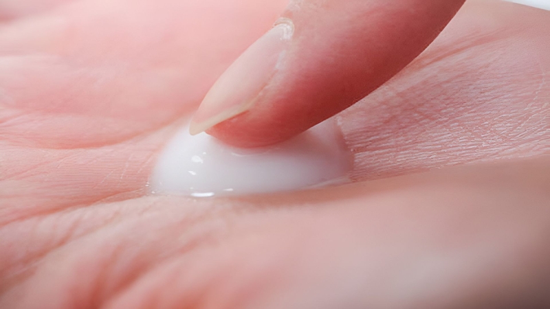 Khí hư màu trắng đục như sữa chua là tình trạng mà nhiều chị em gặp phải