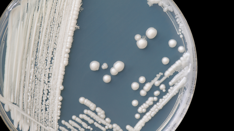 Khí hư vón cục báo hiệu tình trạng sức khỏe như thế nào? Cách phòng ngừa khí hư vón cục 2