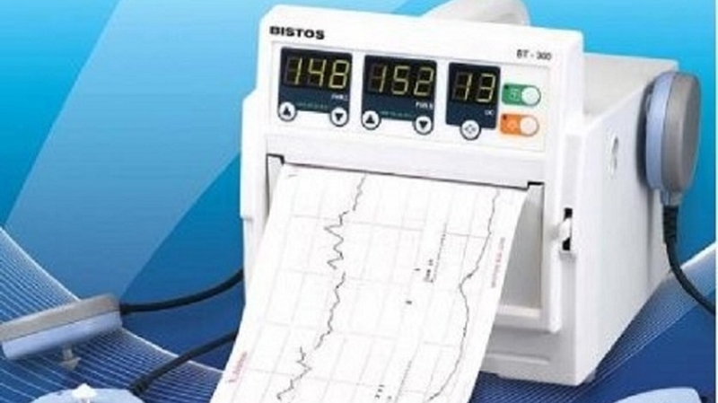 Khi nào bà bầu cần chạy monitor: Hướng dẫn cần thiết cho thai kỳ an toàn 1