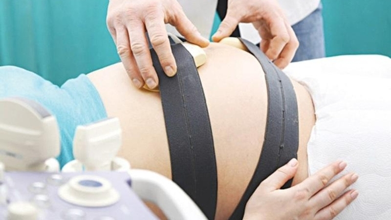 Khi nào bà bầu cần chạy monitor: Hướng dẫn cần thiết cho thai kỳ an toàn 2