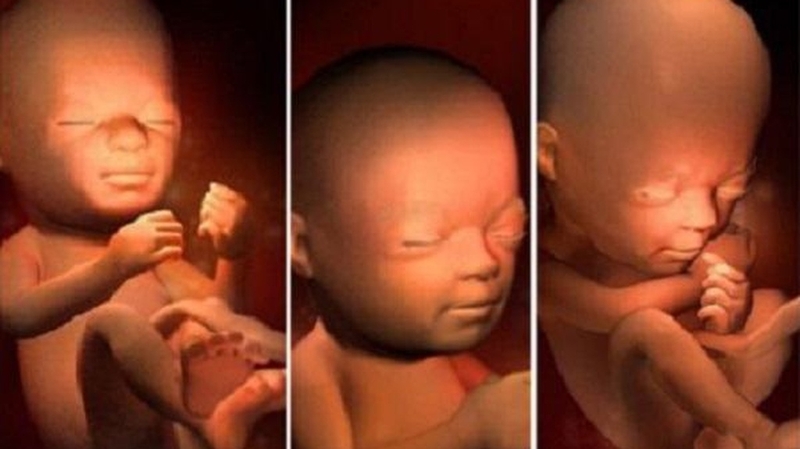 Khi nào bà bầu cần chạy monitor: Hướng dẫn cần thiết cho thai kỳ an toàn 3