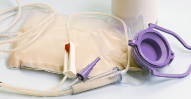 Khi nào cần nuôi ăn qua sonde dạ dày? Những lưu ý khi chăm sóc 3