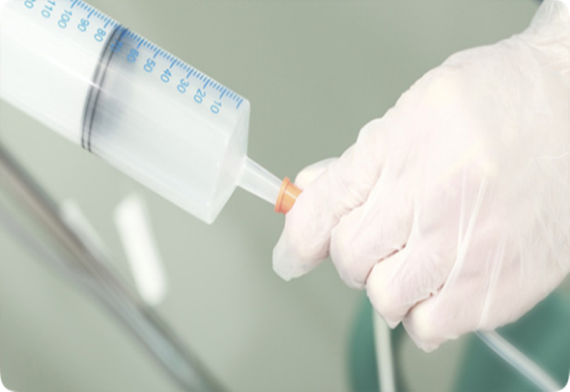 Khi nào cần nuôi ăn qua sonde dạ dày? Những lưu ý khi chăm sóc 4