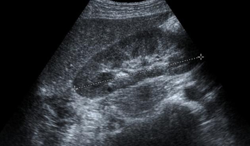 Khi nào cần xét nghiệm viêm gan B?-3