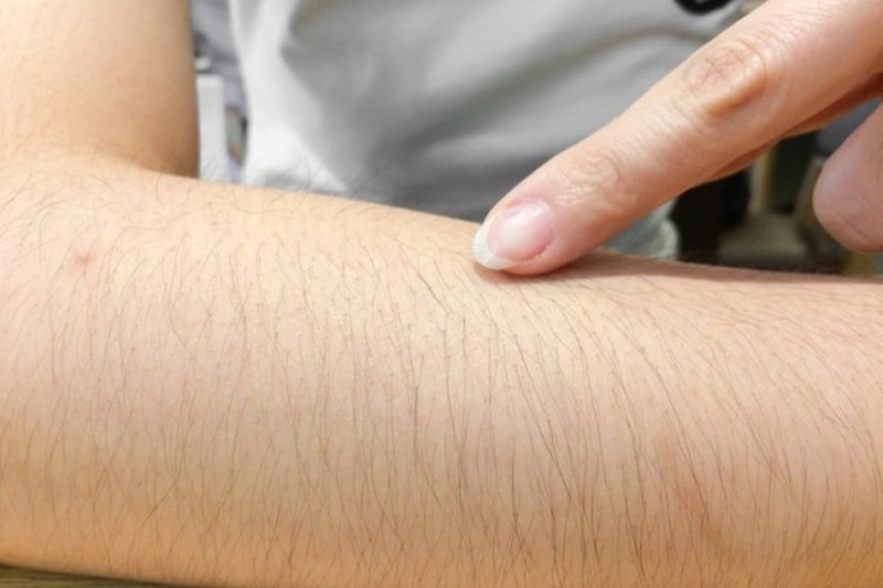 Khi nào cần thực hiện xét nghiệm testosterone? 2