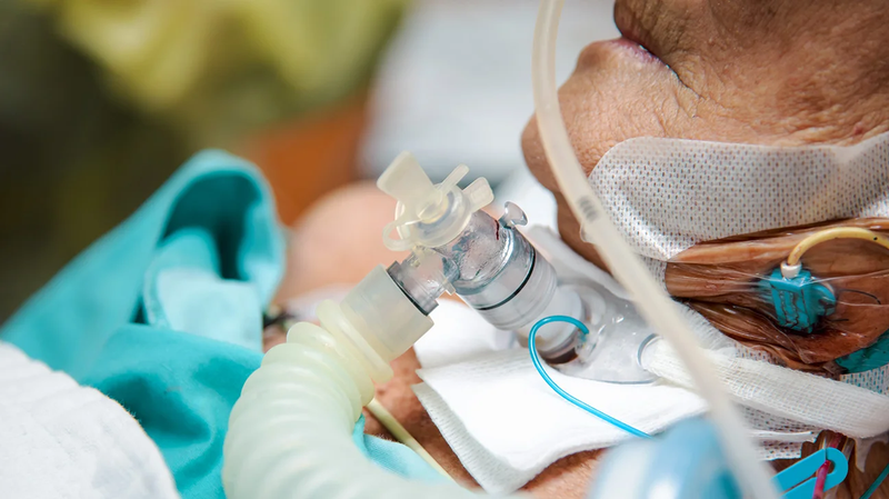 Khi nào mở khí quản cấp cứu được thực hiện? 2