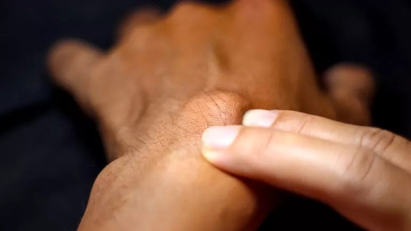 Khi nào nên đi khám hạch? Các vị trí nổi hạch trên cơ thể 3