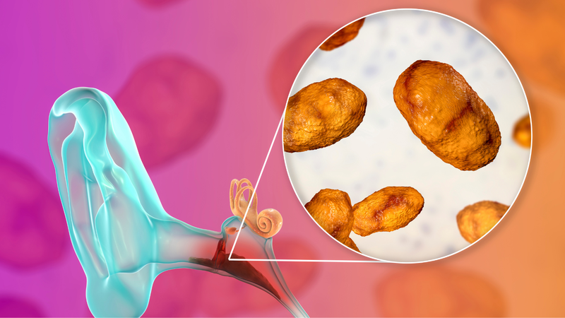 Khi nào nên mổ viêm tai giữa? 1