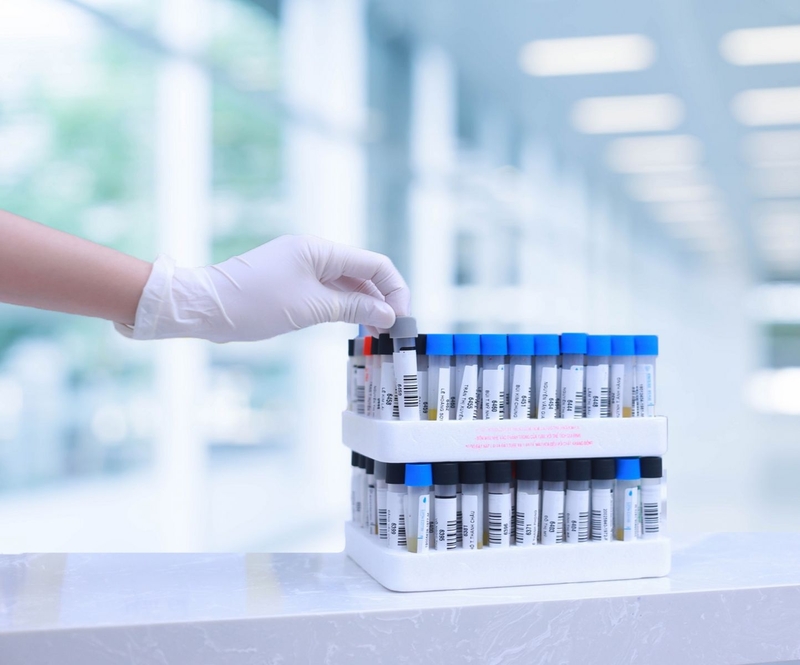 Khi nào nên xét nghiệm nội tiết tố nam và nữ? 3