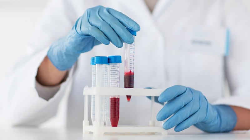 Xét nghiệm tại cơ sở uy tín để đảm bảo kết quả chính xác