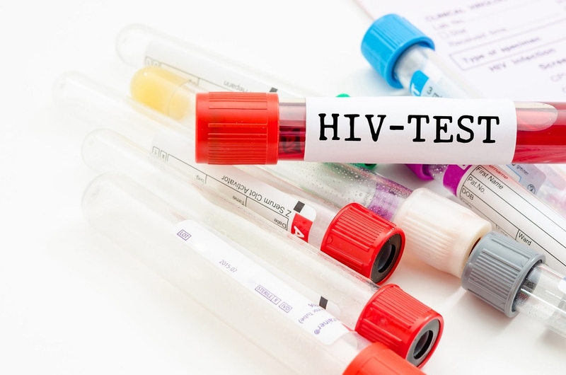 Khi nào thì xét nghiệm HIV để có kết quả chính xác nhất? 3
