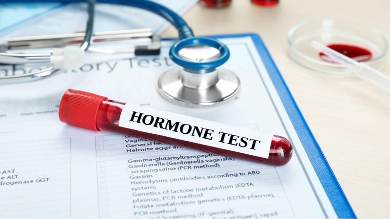 Xét nghiệm hormone giúp đánh giá hoạt động của hệ nội tiết sinh dục ở trẻ
