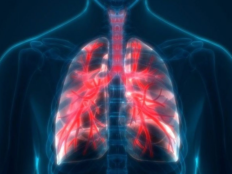 Không có cách chữa khỏi hoàn toàn cho bệnh khí thũng