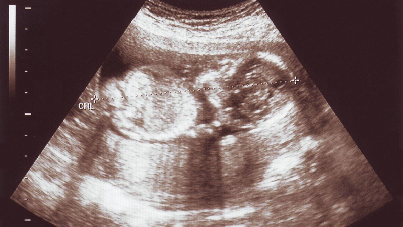 Thai 16 tuần nặng bao nhiêu gam là câu hỏi thắc mắc của nhiều mẹ