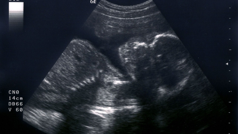 Tay và chân của thai nhi tuần 16 cũng phối hợp cử động nhịp nhàng hơn