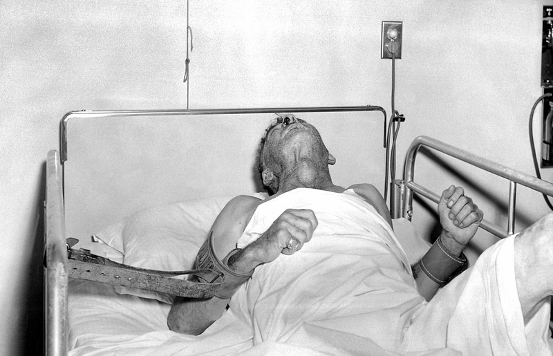 Khi tiêm vắc xin phòng dại kiêng những gì? Lưu ý cần biết khi tiêm phòng dại 1