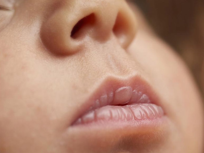 nguyen-nhan-dan-den-tinh-trang-tre-bi-kho-mieng-va-cach-xu-ly-1