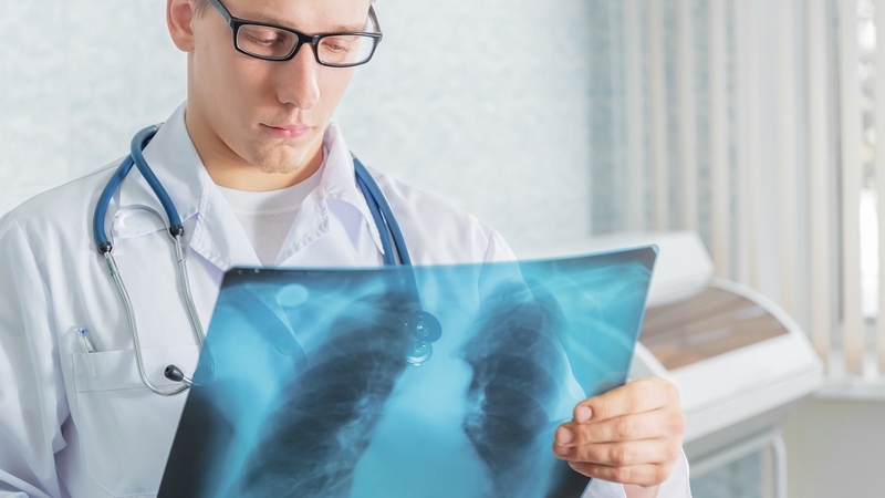 Khoảng cách giữa 2 lần chụp X - quang là bao lâu? 2