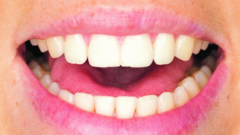 Khoang miệng: Cấu tạo, chức năng và các bệnh lý thường gặp 2