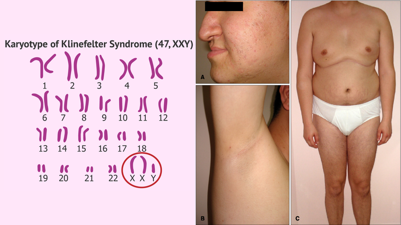 Không có tinh trùng: Nguyên nhân, điều trị và phương pháp phòng ngừa 4